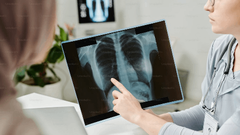 Sanofi’s respiratory pipeline advances with new data in asthma and plans for new clinical studies in COPD